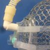 Adapter, for Mask #KM400 - Increases Exhale Port to 35 mm OD (#KM435)